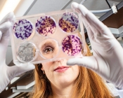scientist looking through glass of petri dish at camera